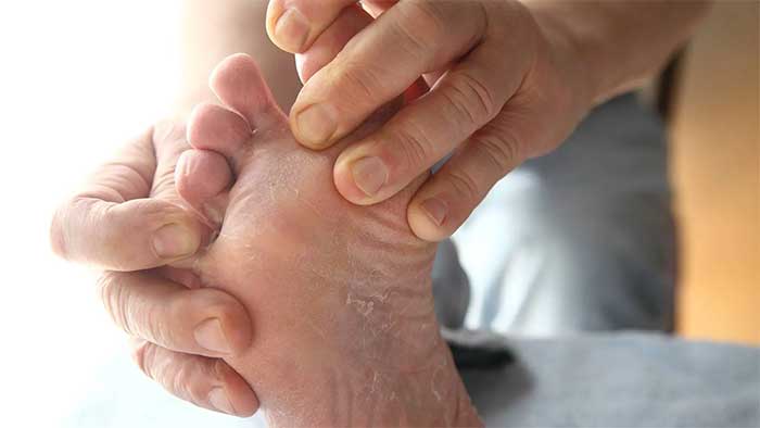 Giữ bàn chân khô ráo