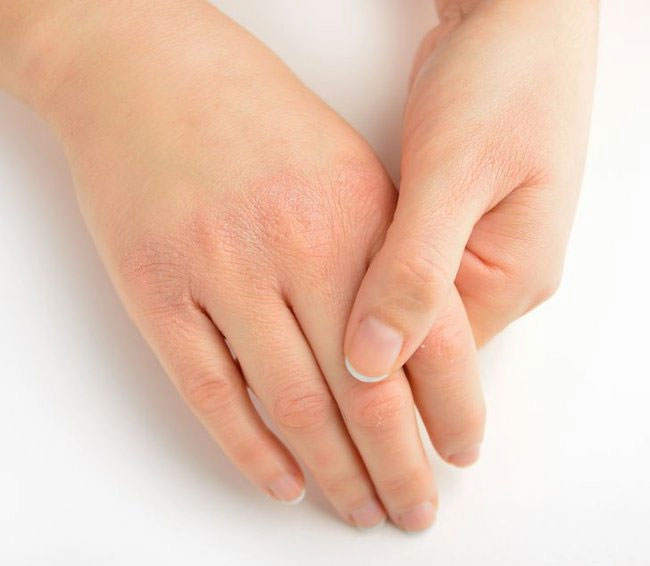 Da có dấu hiệu dày sần