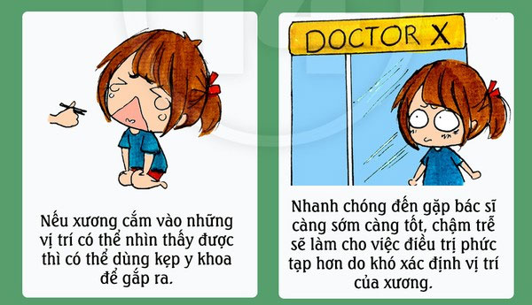 Khi hóc xương cá, hãy đến bác sĩ Giải quyết tình trạng hóc xương cá