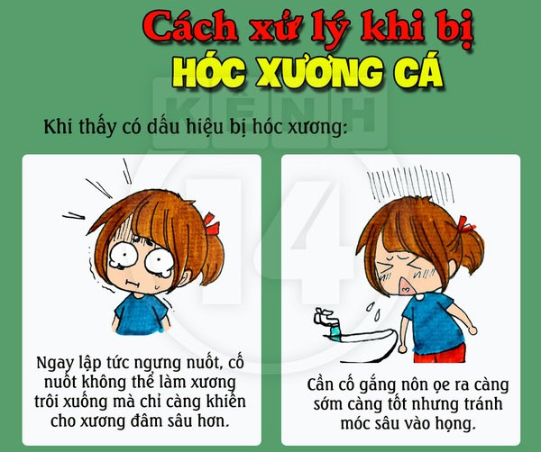 Ngừng nuốt khi có dấu hiệu hóc xương Giải quyết tình trạng hóc xương cá