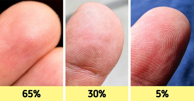 12 Đặc Điểm Cơ Thể Hiếm Gặp Làm Nên Sự Độc Đáo Của Bạn